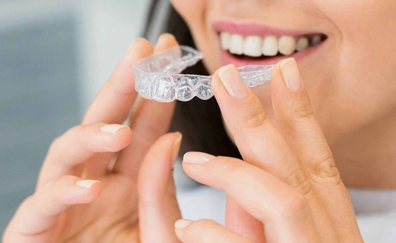 putting invisalign at dene dental in northwood