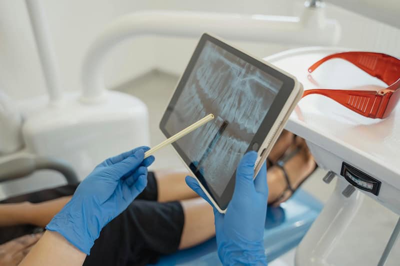 root canal at Dene Dental